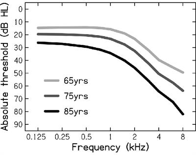 Immediate Effects of (Simulated) Age-Related Hearing Loss on Cognitive Processing and Performance for the Backward-Digit-Span Task